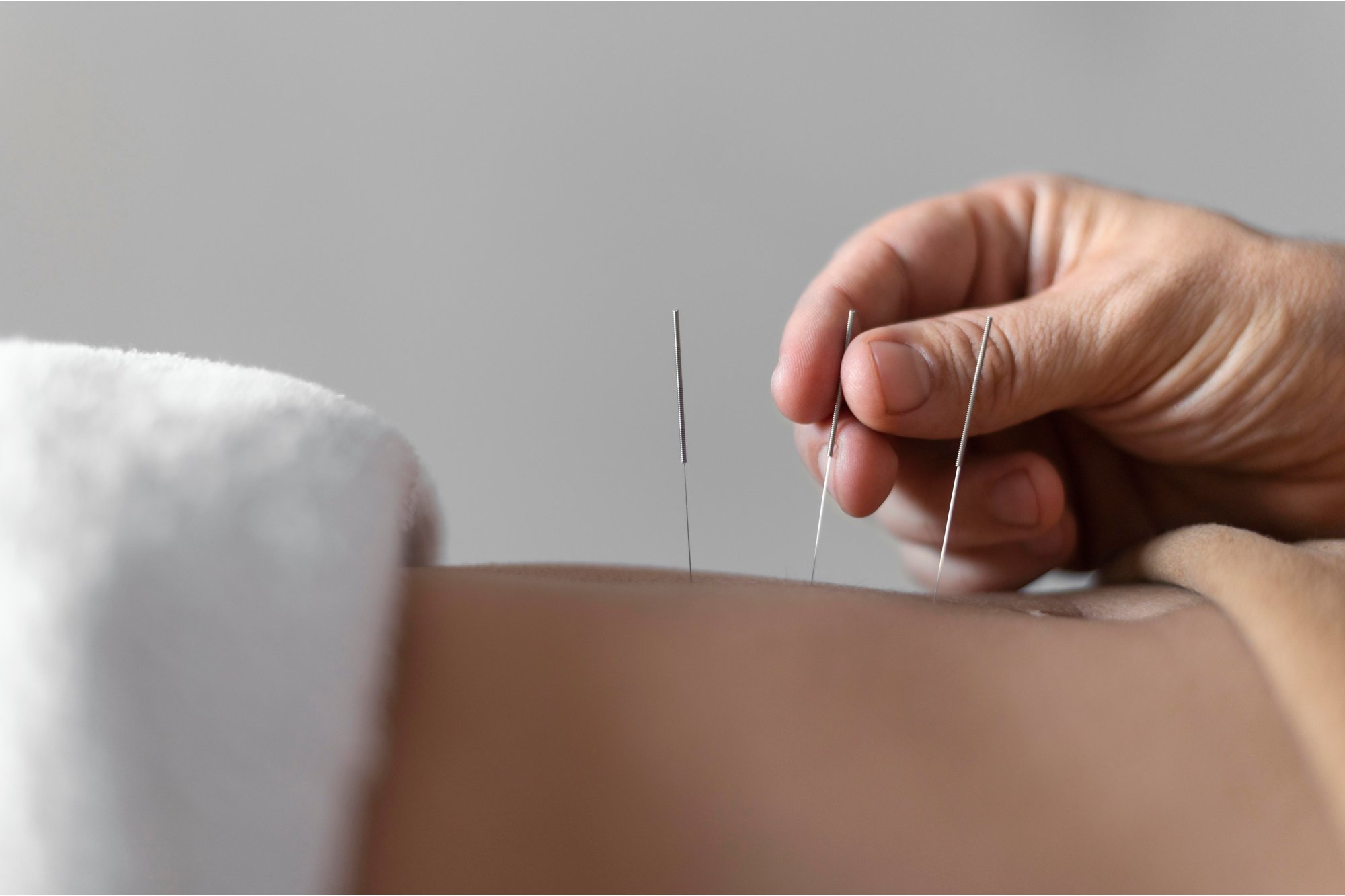 soluciones-tecnologicas-para-centro-de-acupuntura